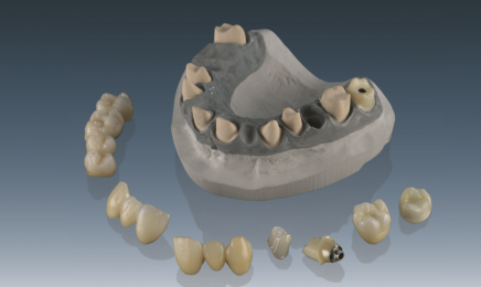 Ceramill Zi