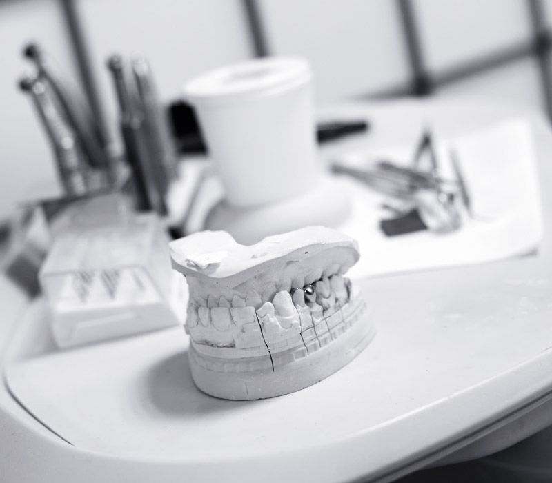 Thạch cao vàng- Thạch cao siêu cứng